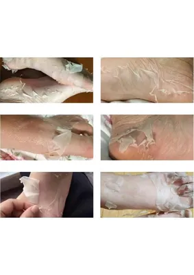GüncelÇarşı Ayak Peeling Maskesi Nasır, Ölü Deri Temizleyici, Nemlendirici Özellik, Lavanta Yağı ve