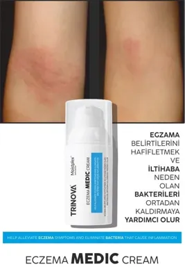 Trinova Egzema kremi