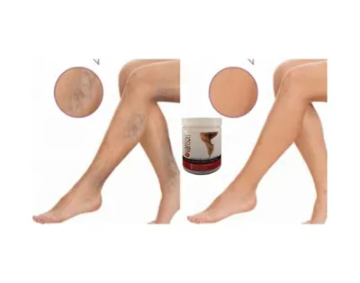 Bezos On Selüllit Bacak Bakım Kremi 200 Ml X 2adet Dlra 46544444