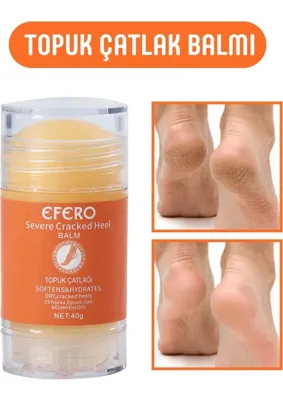 Tbyshop Tby Shop Kuru Ve Yıpranmış Ayaklar & Topuklar İçin 40G Ayak Ve Topuk Kremi Onarıcı Özellikli