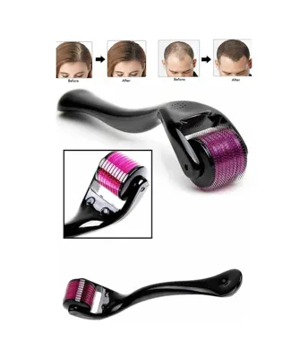 Skygo Derma Roller Titanyum Uçlu 540 Iğneli 1 Mm Iğne Tkdytgs8vbj93arızkl
