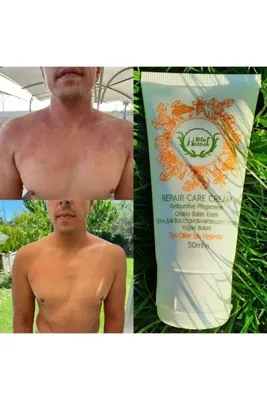 BİOHERBAL Onarıcı Bakım Kremi(EGZAMA,DERMATİT,SEDEF)