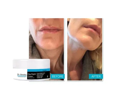 Bezos Dr Botokss Cildinizin Yeniden Yapılanması İçin Kırışıklık Giderci Bakım Kremi 50 Ml X 1 Adet Bezos1