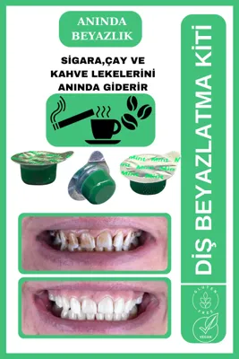AVANT DENTAL SUPPLY 3 Tüp Diş Beyazlatıcı Nane Aromalı Sigara Çay Kahve Lekesi Için Profesyonel Bakım(3 AYLIK)